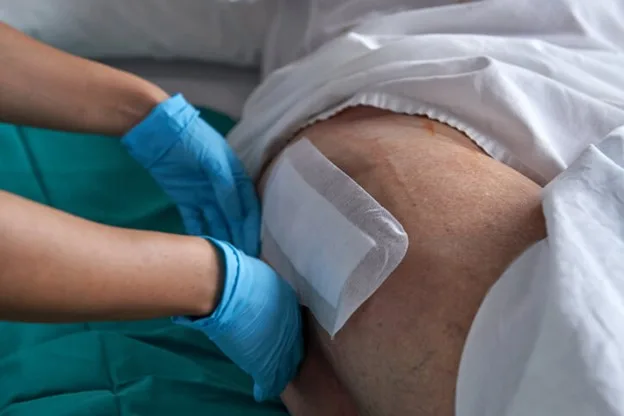 What Is the IWC Model, and How Does It Revolutionize Wound Care?